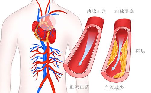 動脈硬化檢測儀