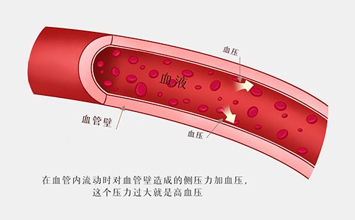 動脈硬化檢測儀