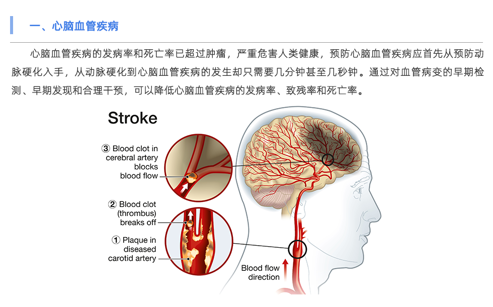 動脈硬化檢測儀