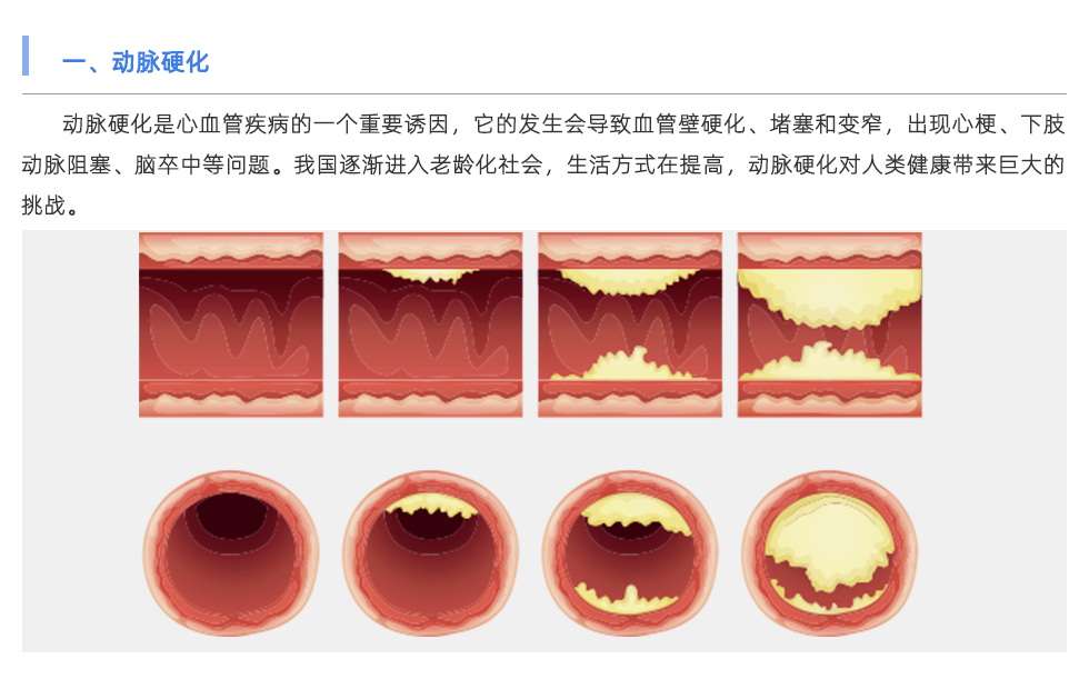動(dòng)脈硬化檢測(cè)儀