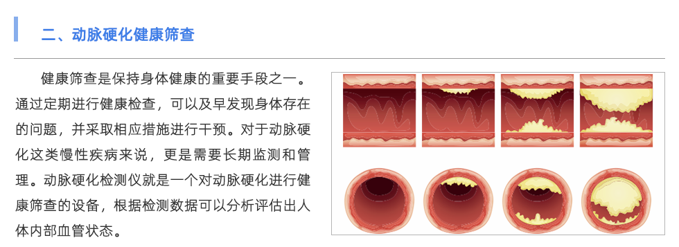 動(dòng)脈硬化檢測儀