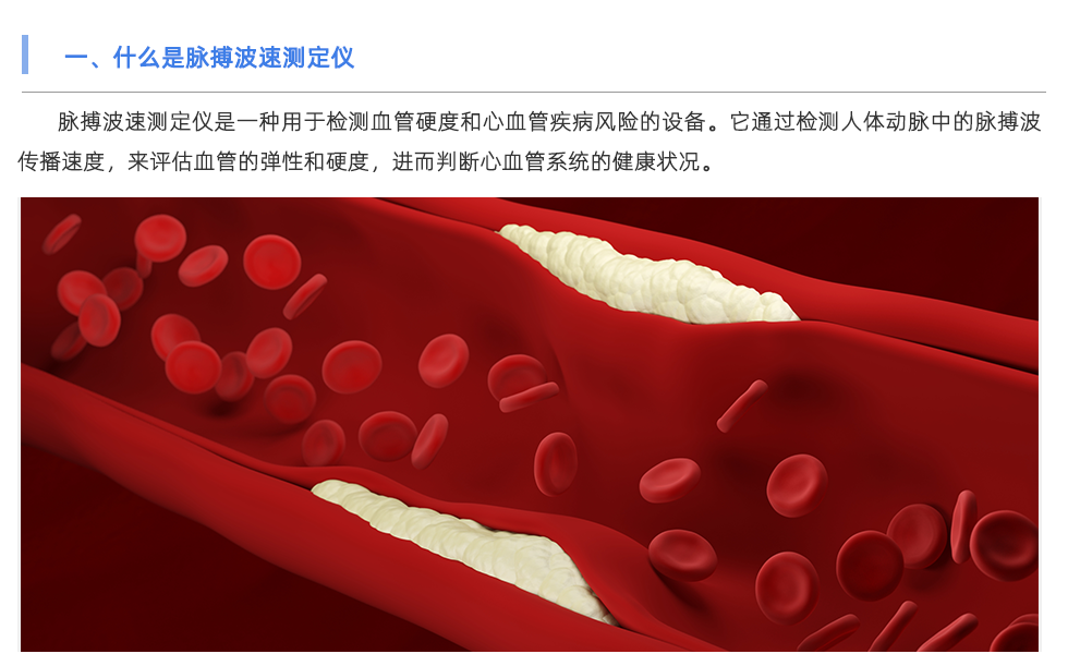 脈搏波速測(cè)定儀