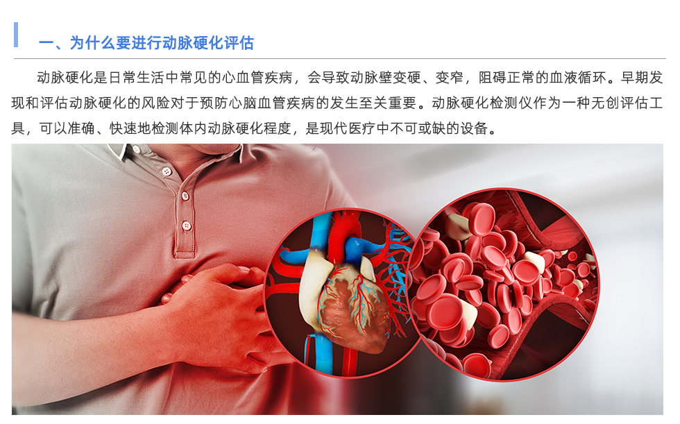 動(dòng)脈硬化檢測儀