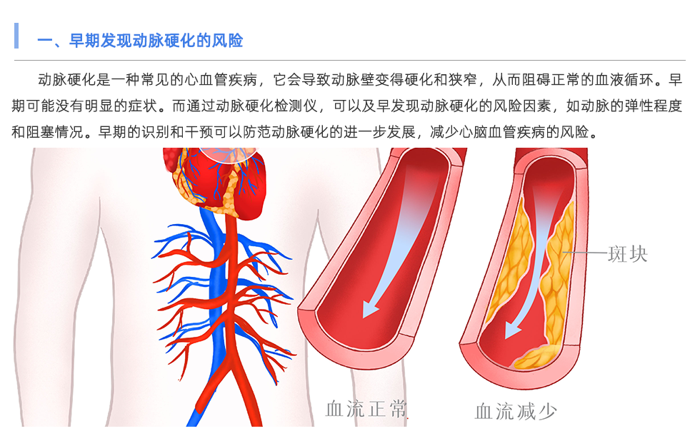 動(dòng)脈硬化檢測(cè)儀
